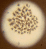 brachionus