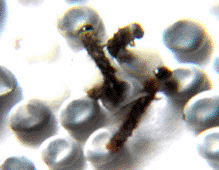 �closion oeufs de vers � soie